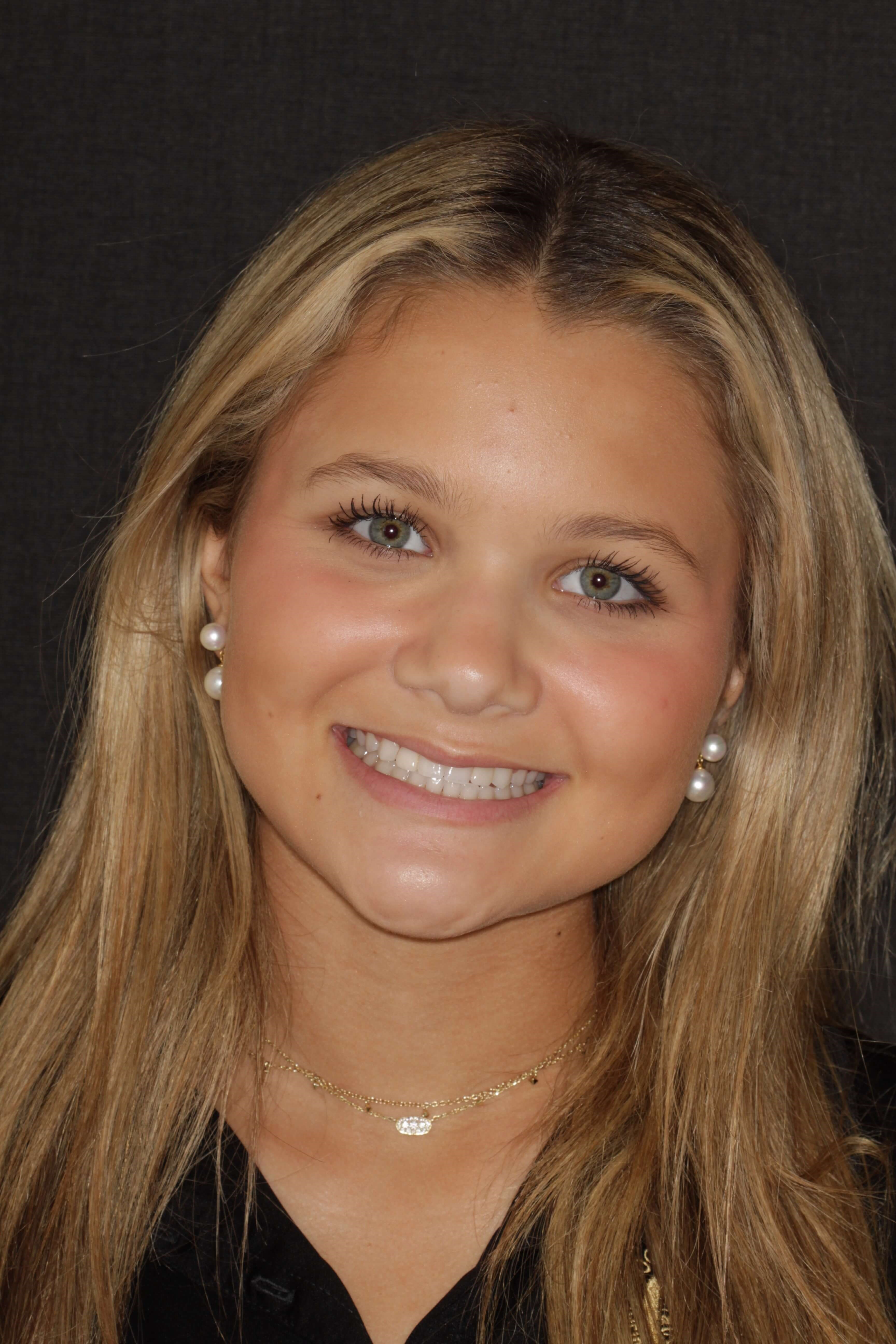 Smile Makeover Portrait  Smile Makeover Portrait