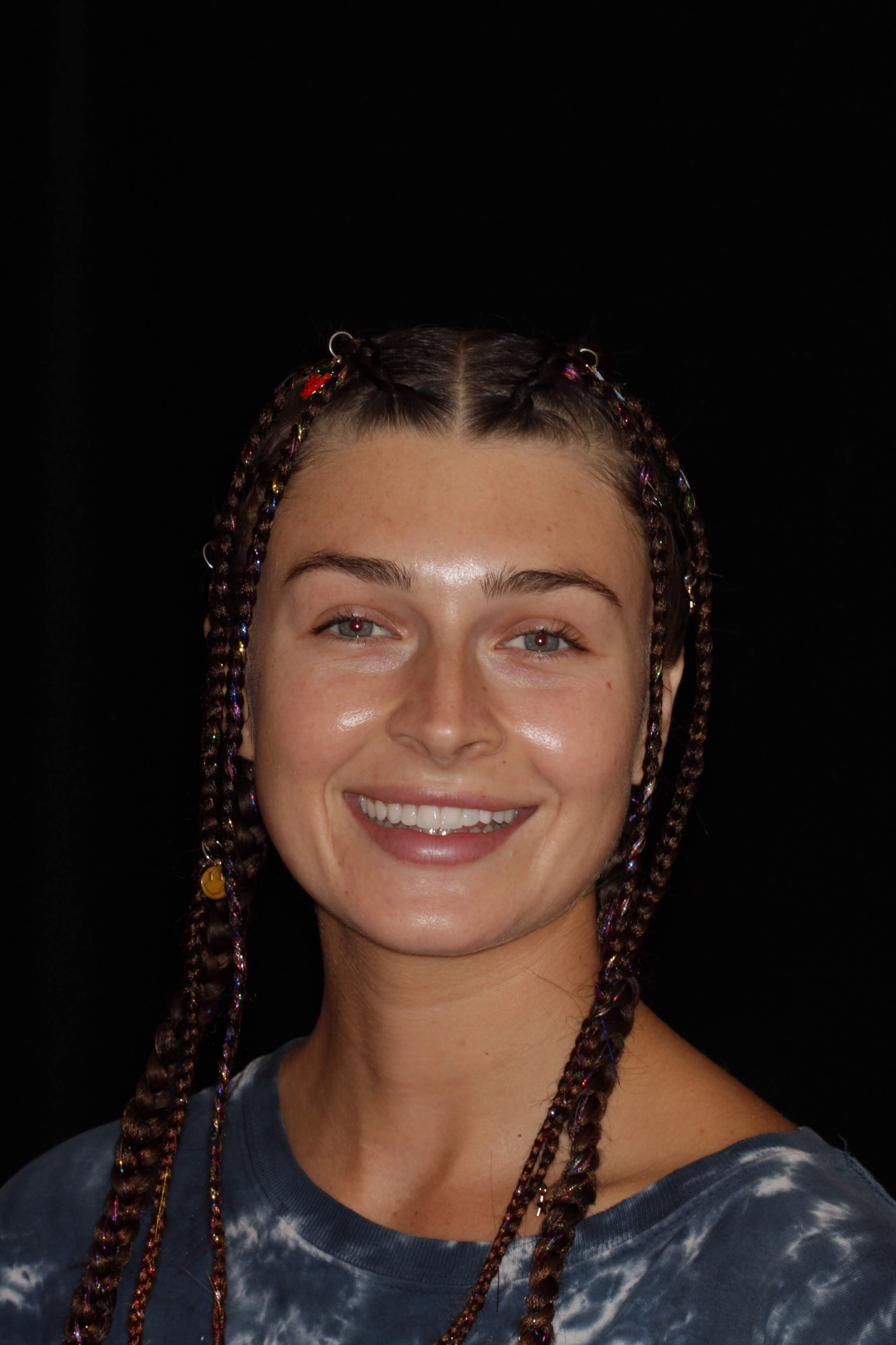 Smile Makeover Portrait 