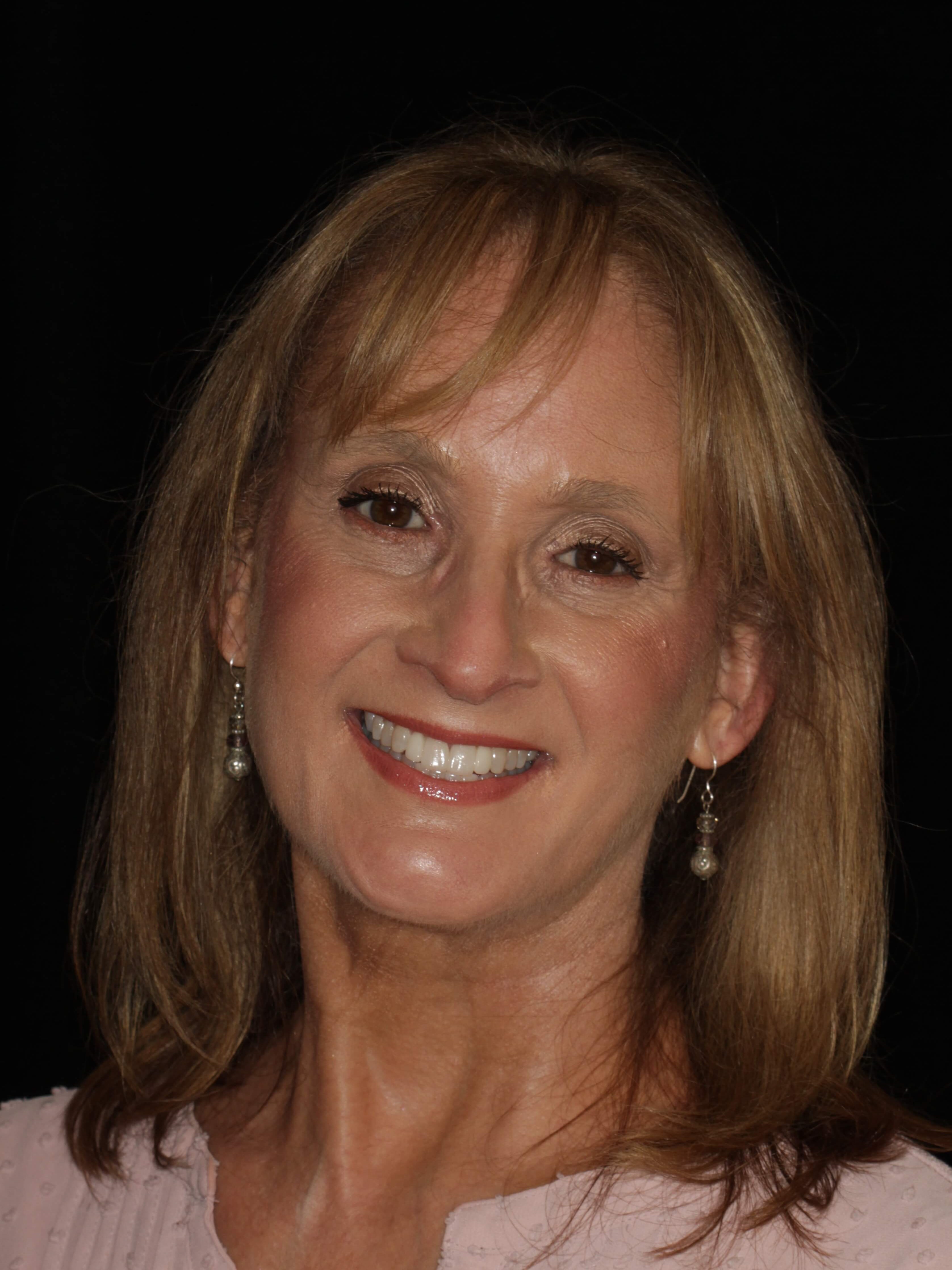 Smile Makeover Portrait 