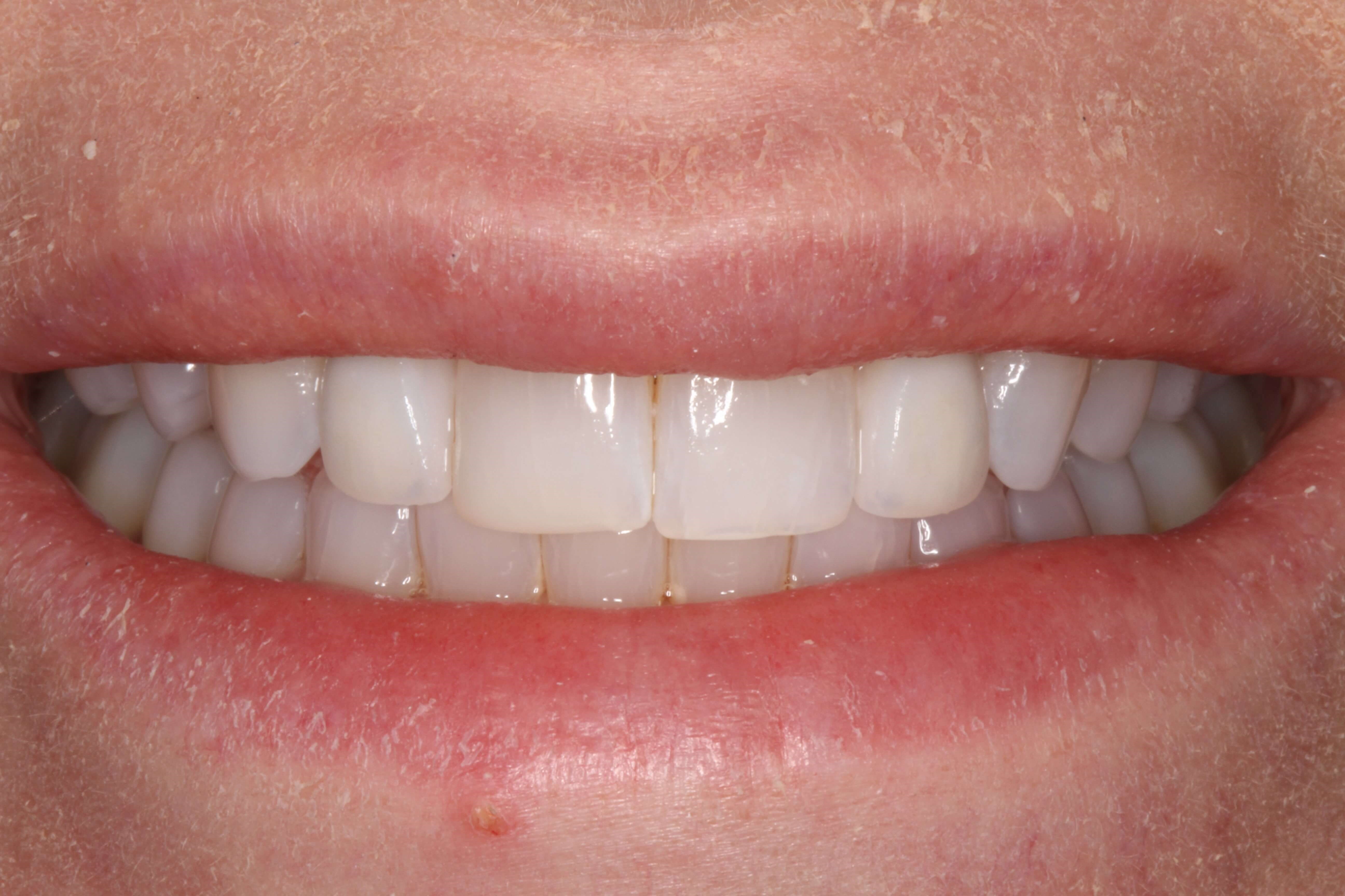 Before and After Photos After