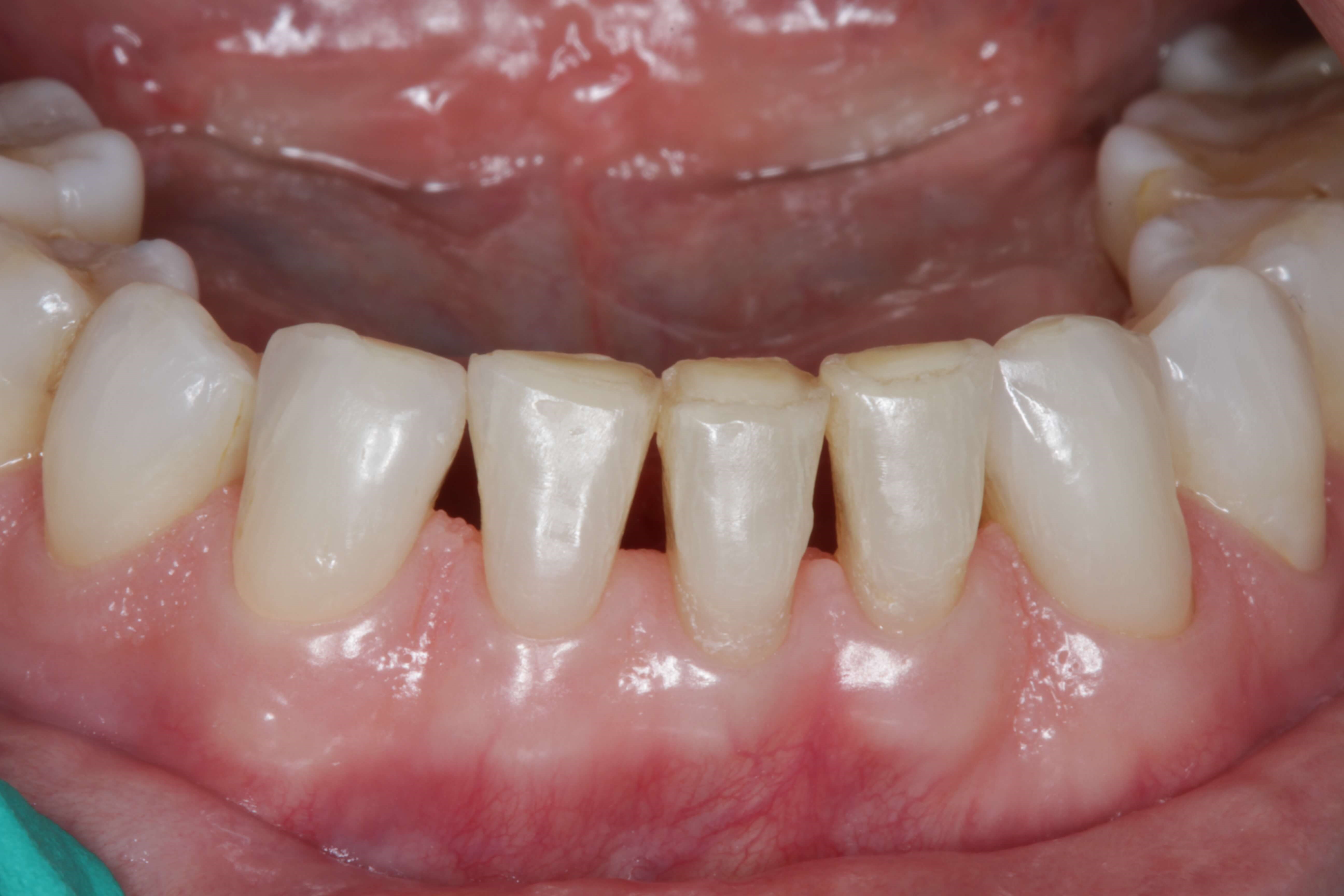 Before Image
