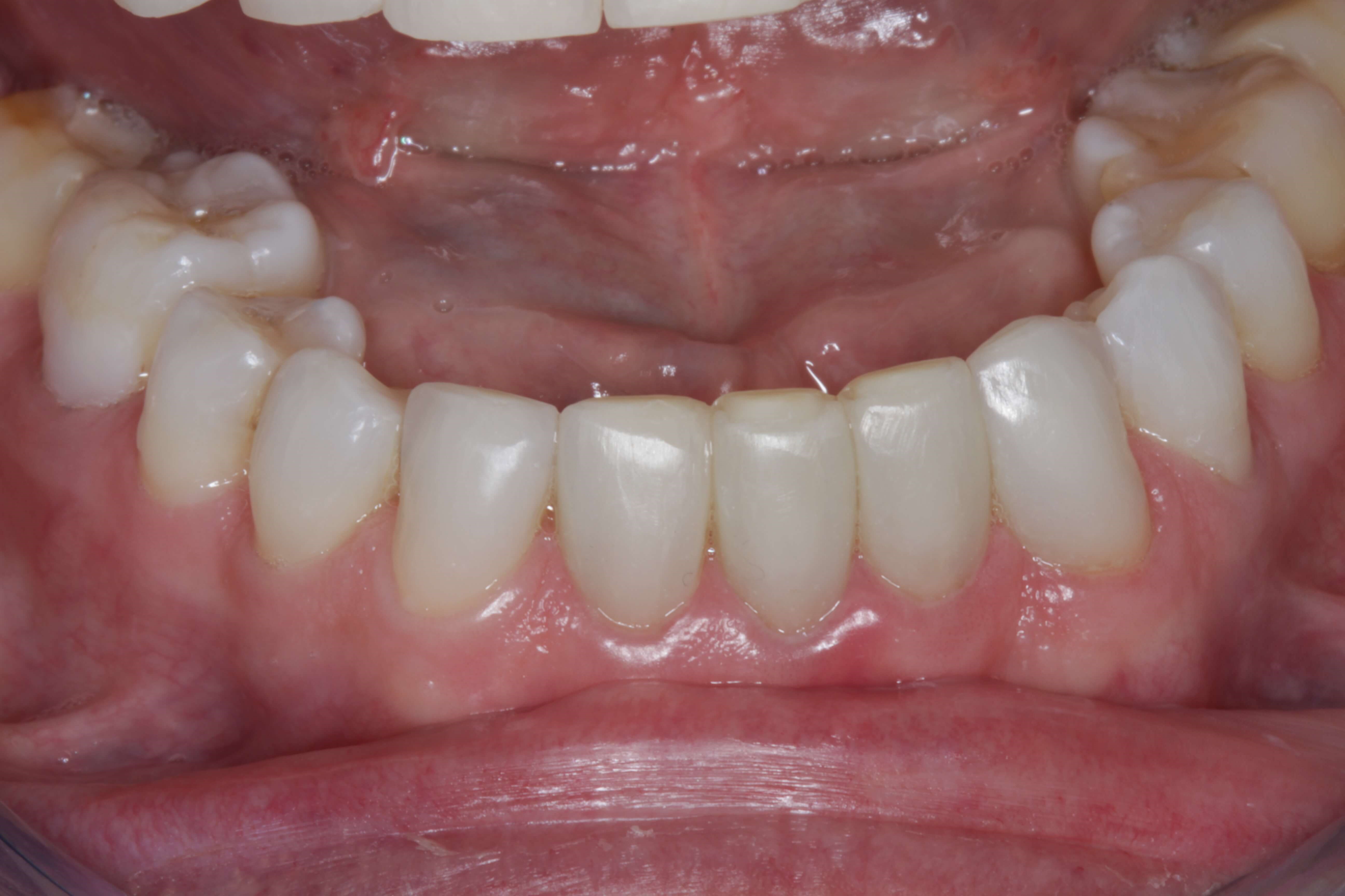 After Image