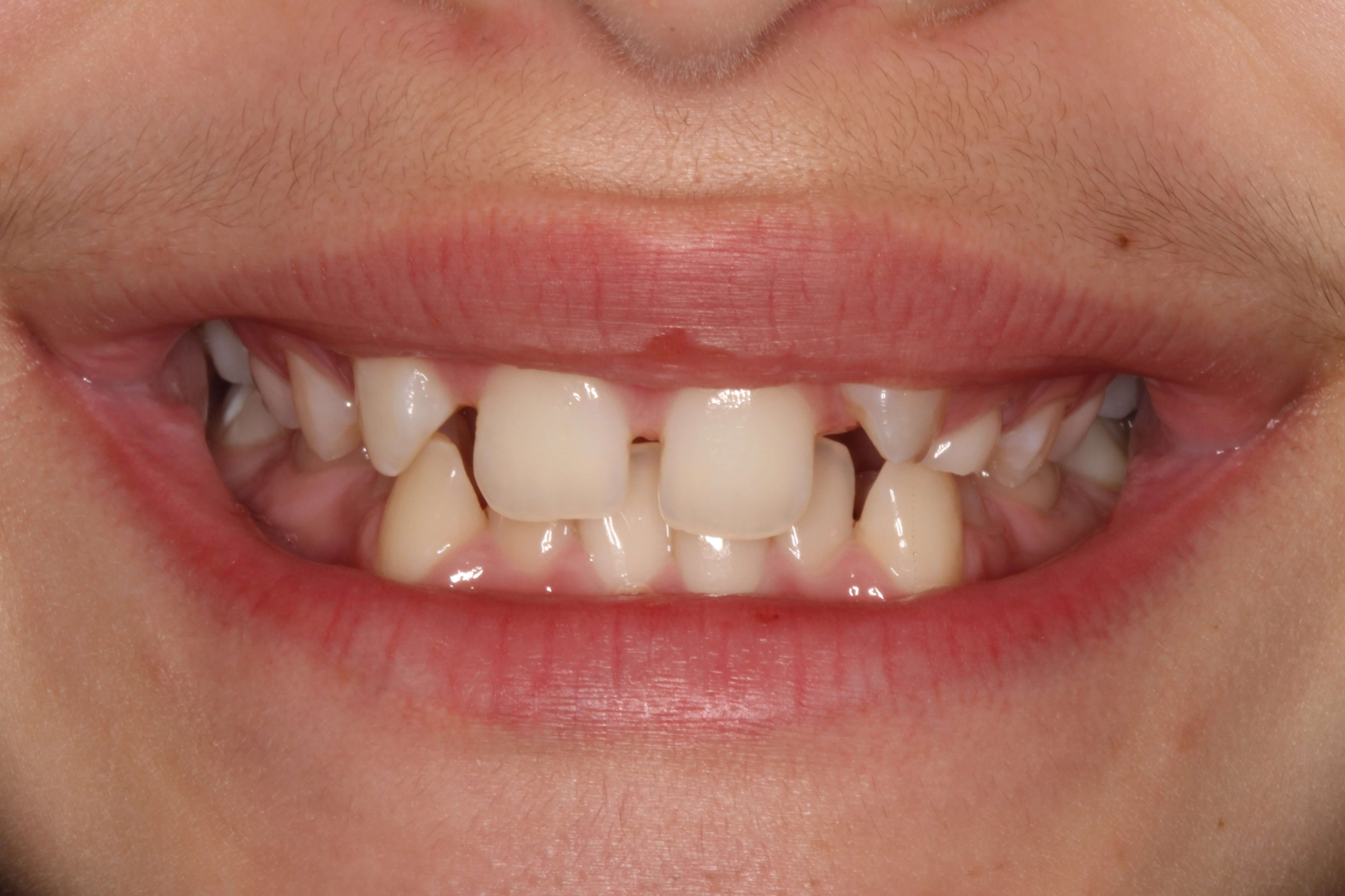 Before Image