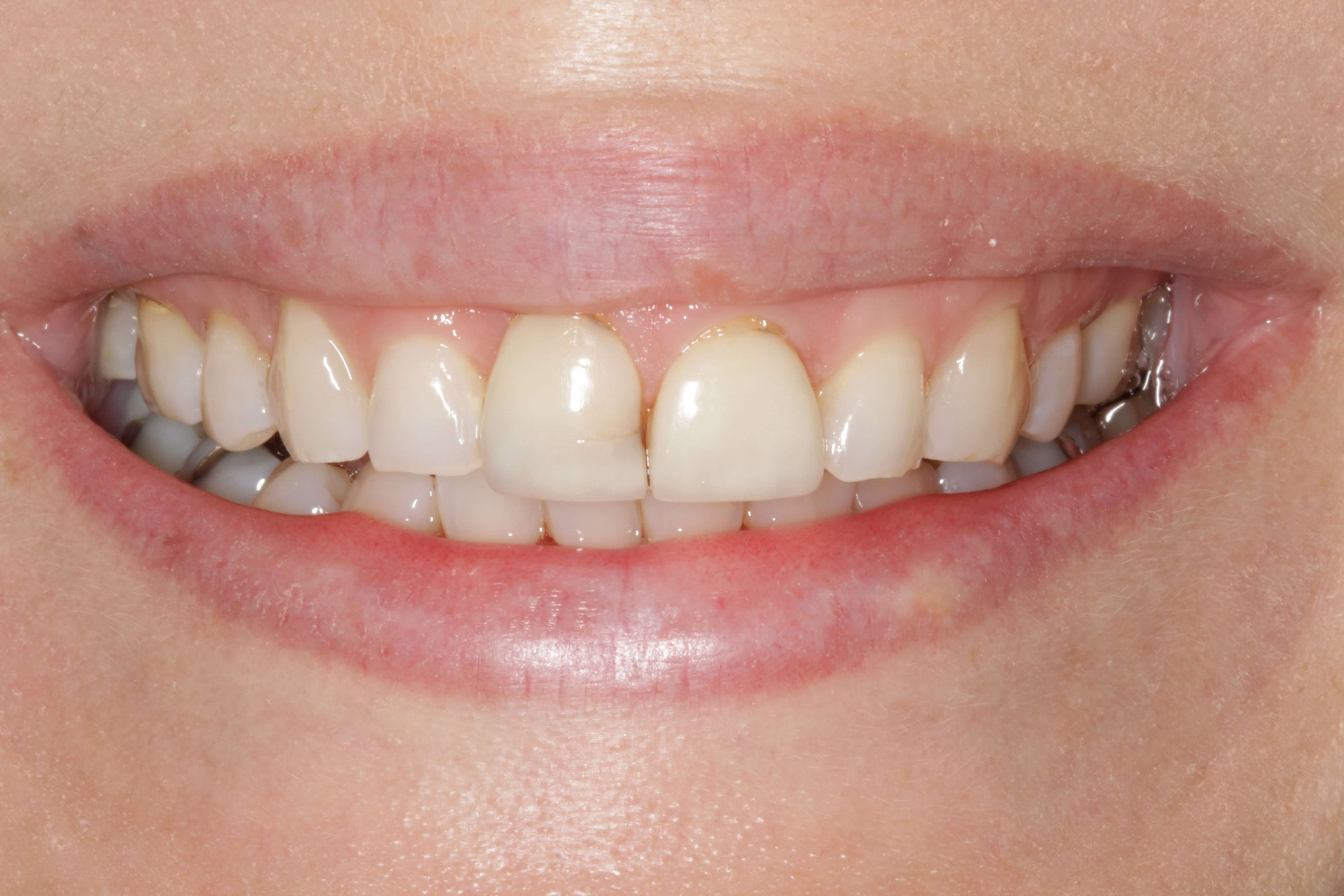 Before Image