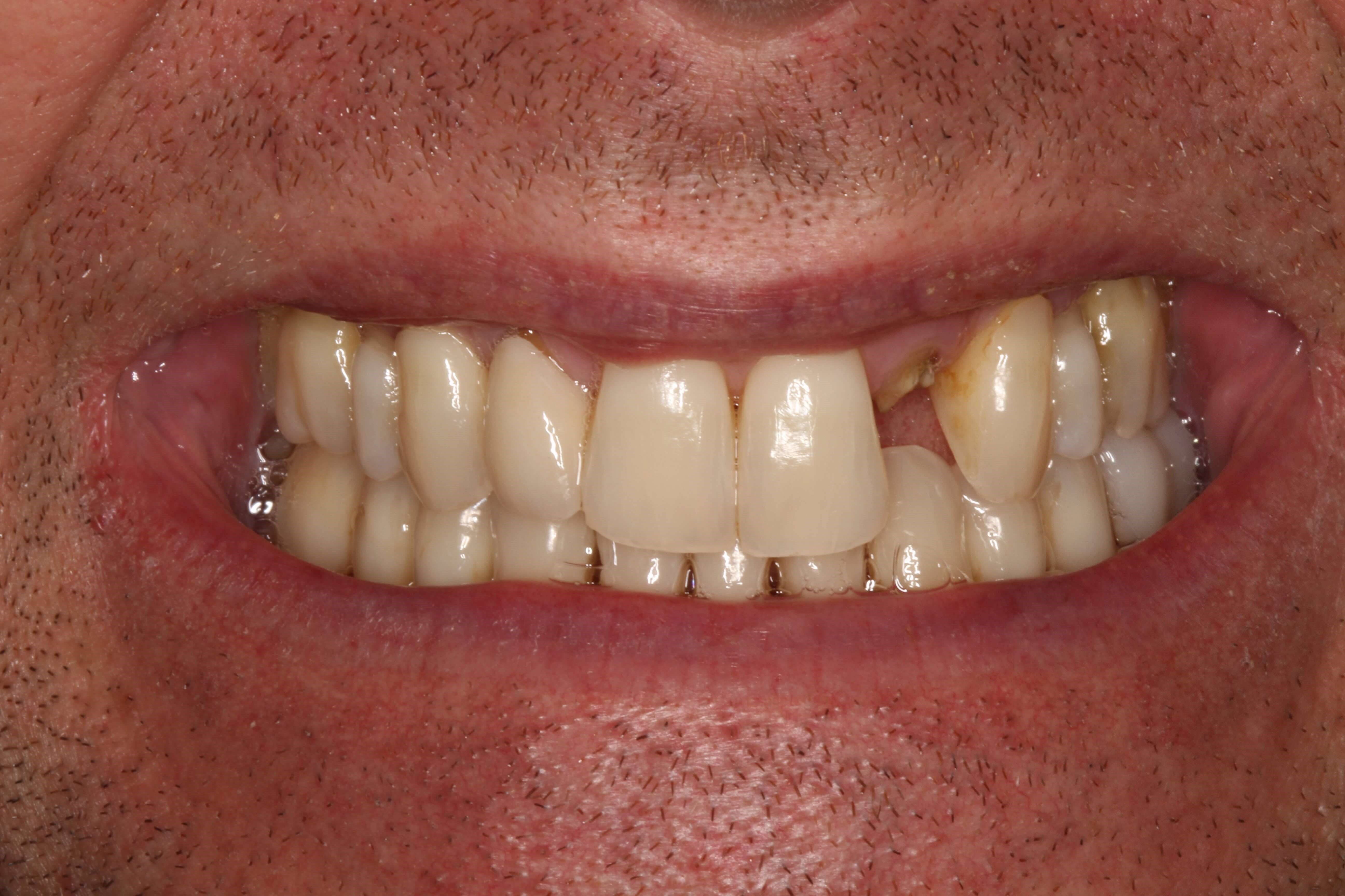 Before Image
