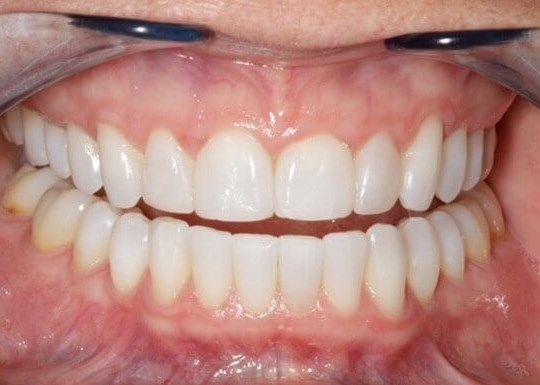 Post 2 Image 3