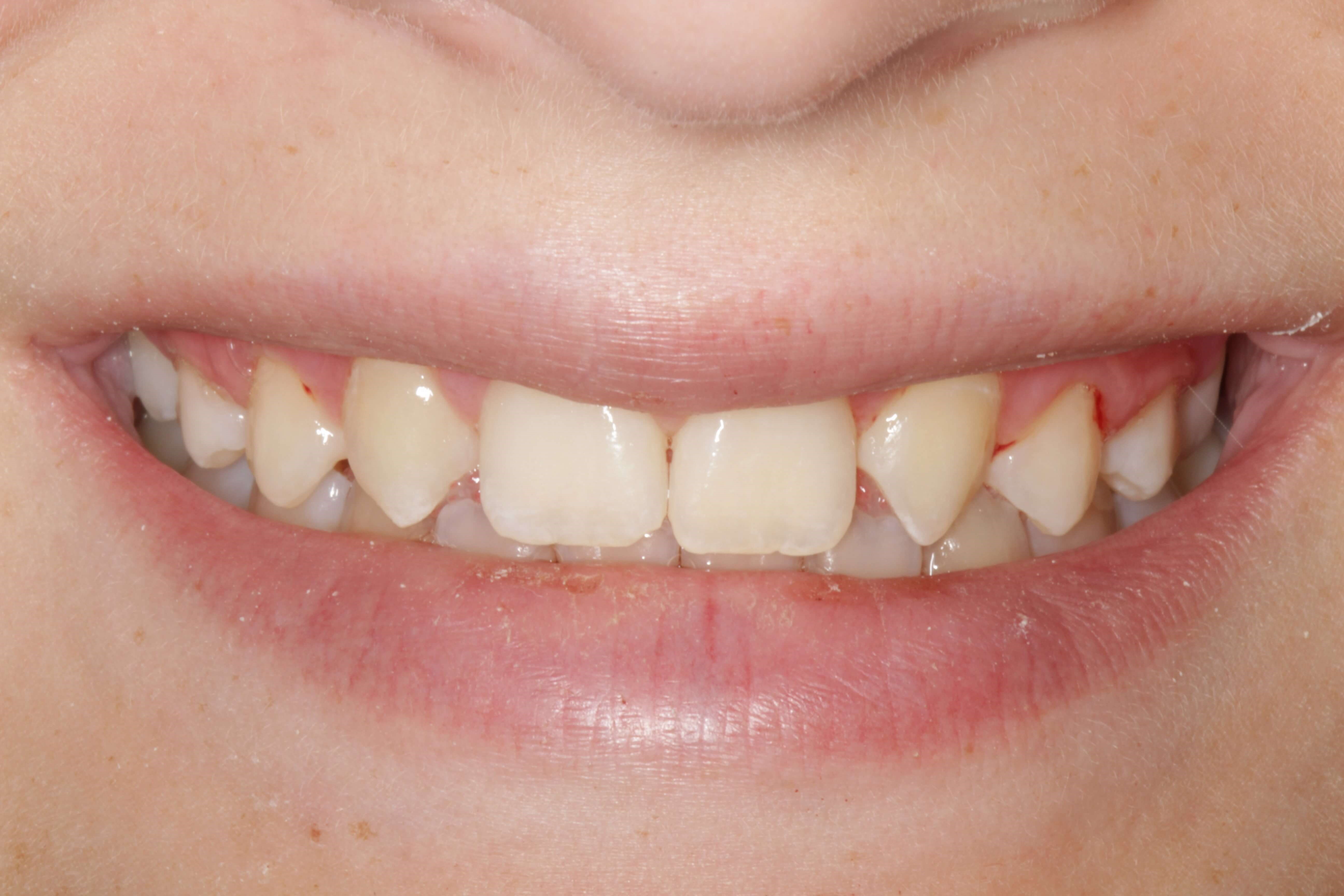 Before Image