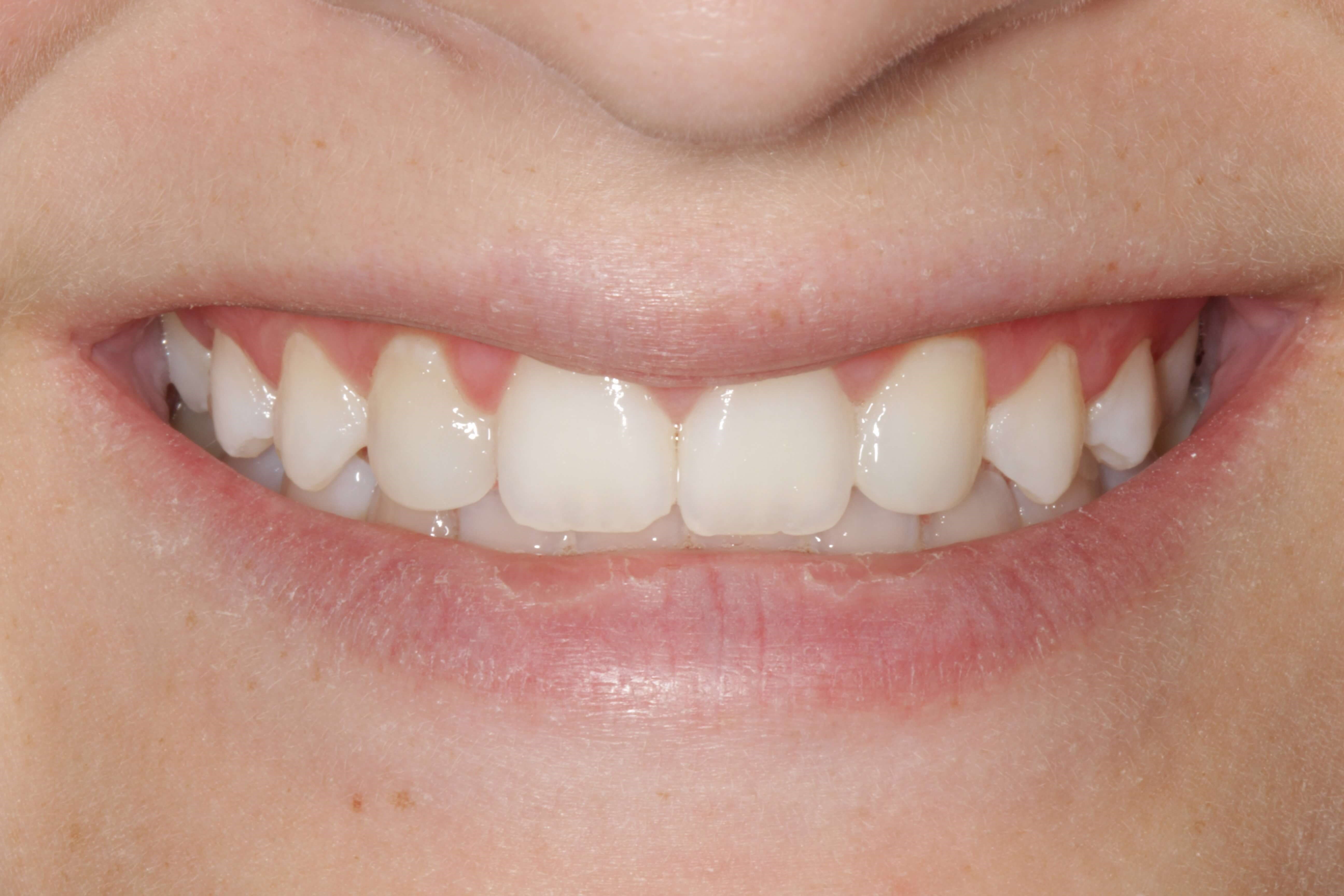 After Image