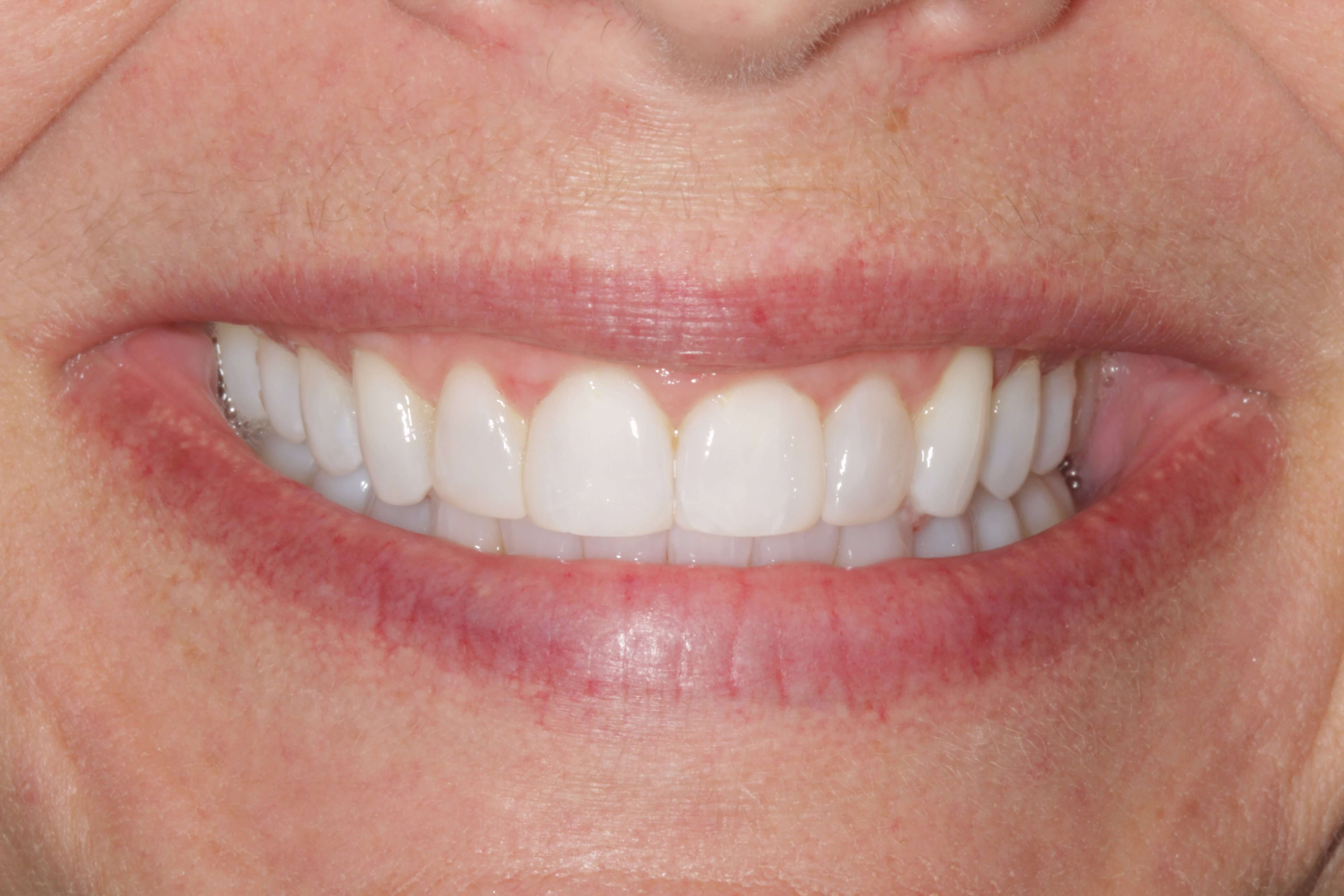 Before Image