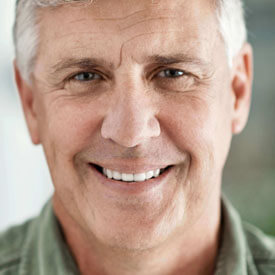 Full-Mouth Reconstruction